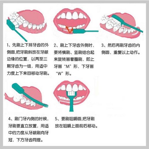正确的刷牙方式