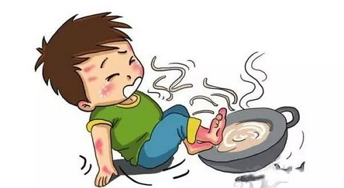 烫伤后的水泡是什么