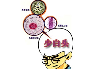“少白头”是一种病吗