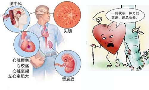 高血压的症状与危害