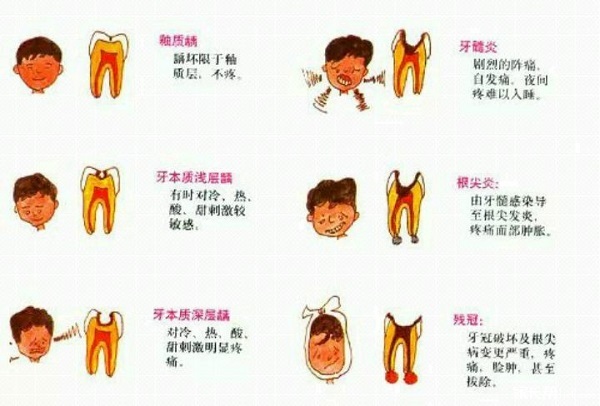 蛀牙的演变过程